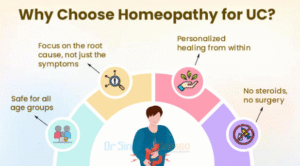 Why choose homeopathy for UC