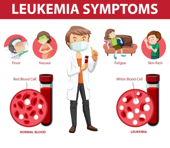 Thrombocytosis: Causes, Symptoms, and Treatment Options
