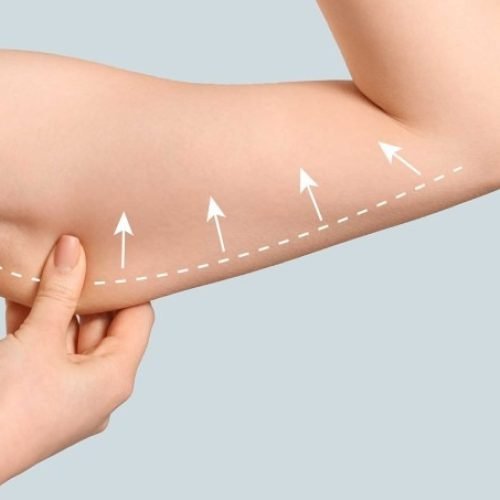 Unlocking Confidence and Toned Arms with an Extended Arm Lift in Bangkok