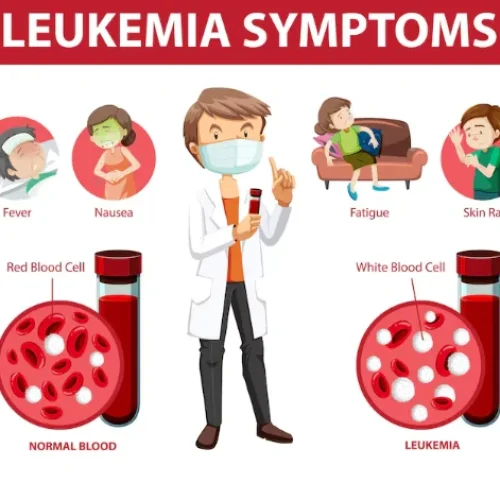 Thrombocytosis: Causes, Symptoms, and Treatment Options
